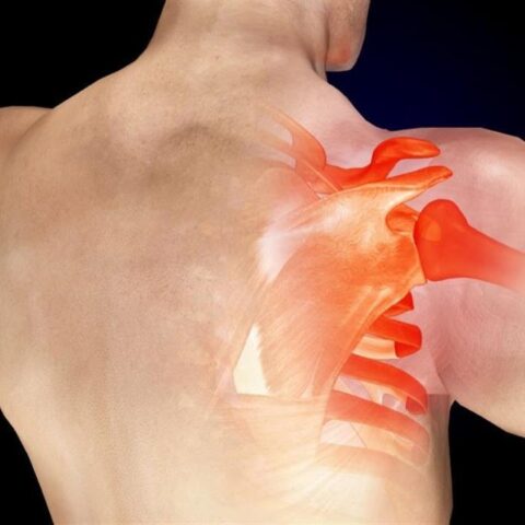 برنامج تأهيل عمليات مفصل الكتف post op shoulder arthroplasty rehablitation Program