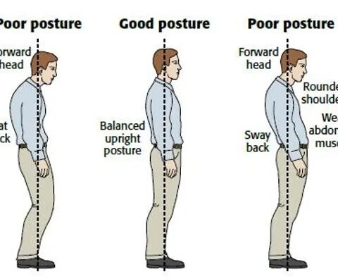 التحليل الدقيق لمشاكل القوام Comprehensive Posture analysis