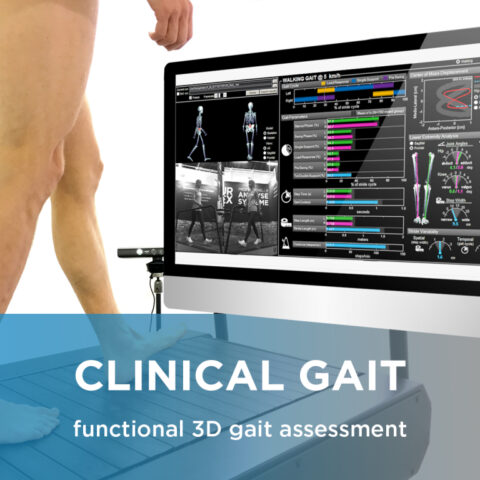 التحليل الدقيق لمشاكل المشي comprehensive gait analysis