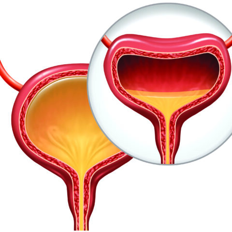 تأهيل السلس البولي Urinary Incontinece Rehab