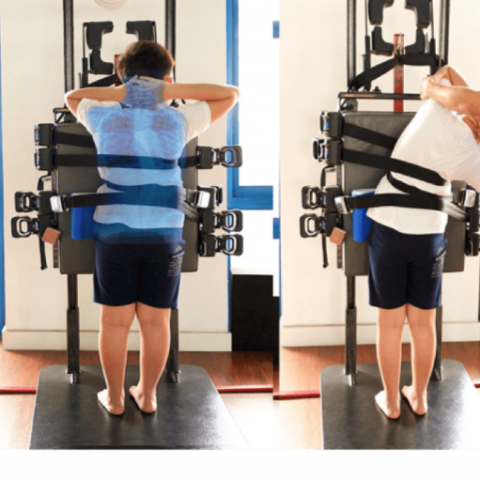 برنامج تأهيل الجنف القطني Scoliosis rehabilitation program
