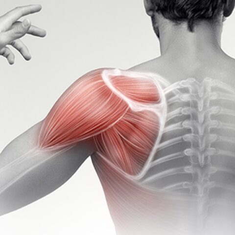 تأهيل الكتف Shoulder Rehab