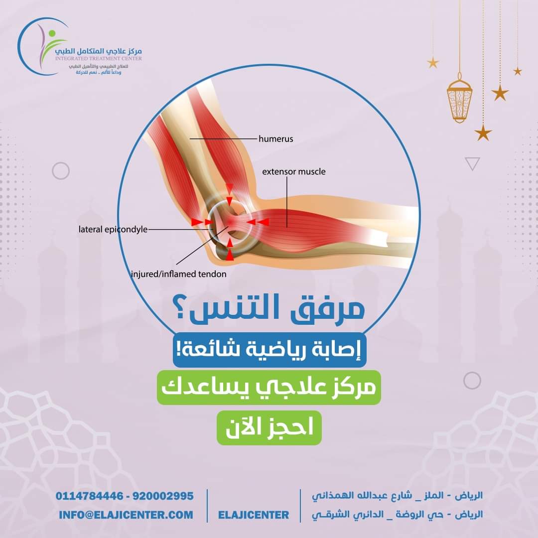 مرفق التنس